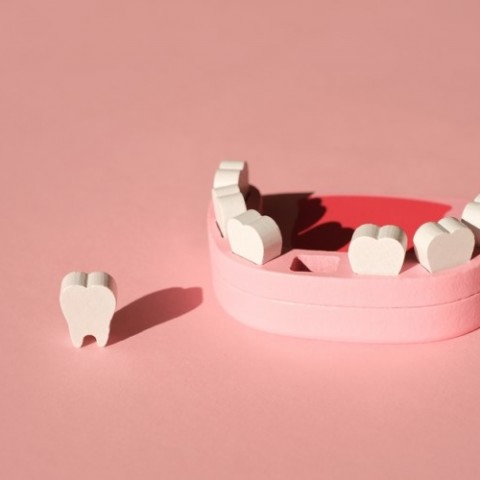 すきっ歯になる原因と治療方についてサムネイル