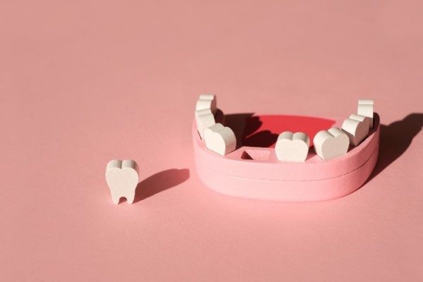 すきっ歯になる原因と治療方についてサムネイル